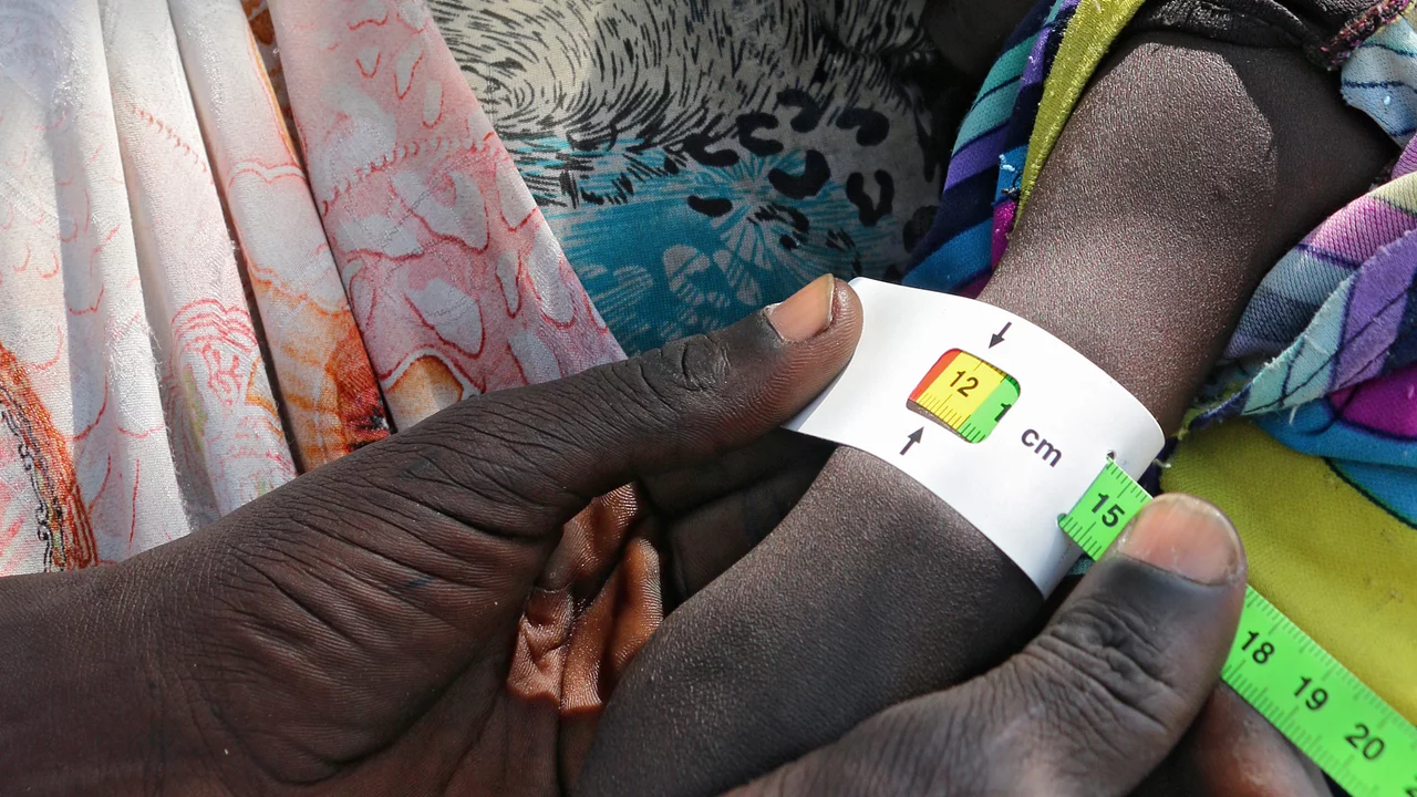 Bei einem Baby wird im Südsudan der Armumfang gemessen